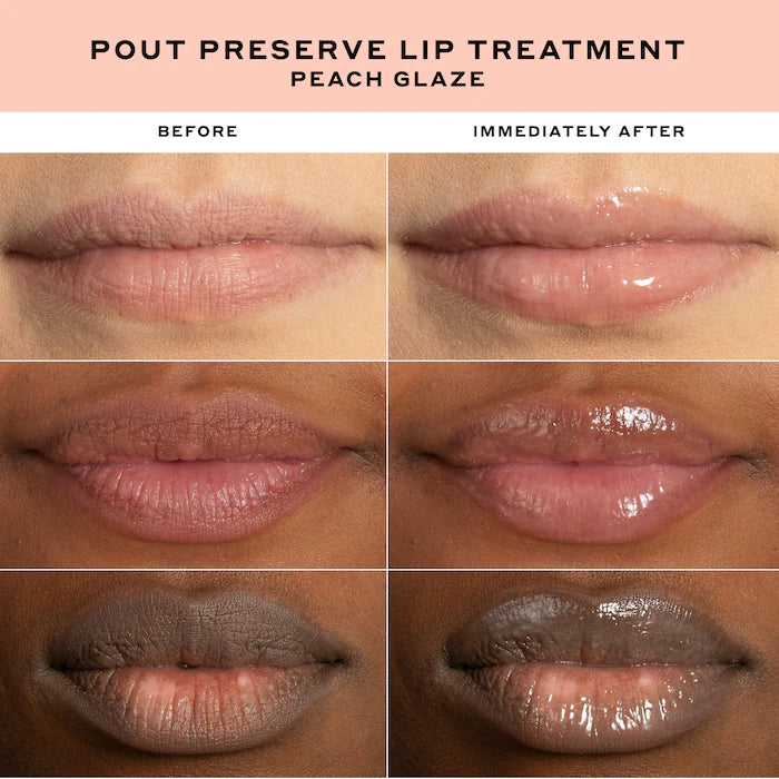 Pout Preserve Hydrating Peptide Lip Treatment - PREVENTA
