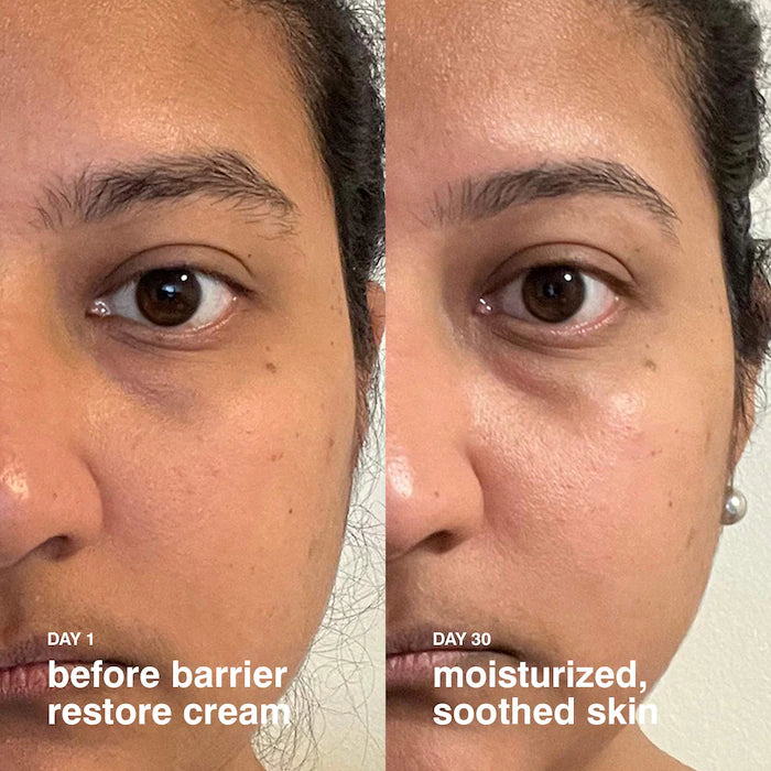 Barrier Restore Cream Preventa