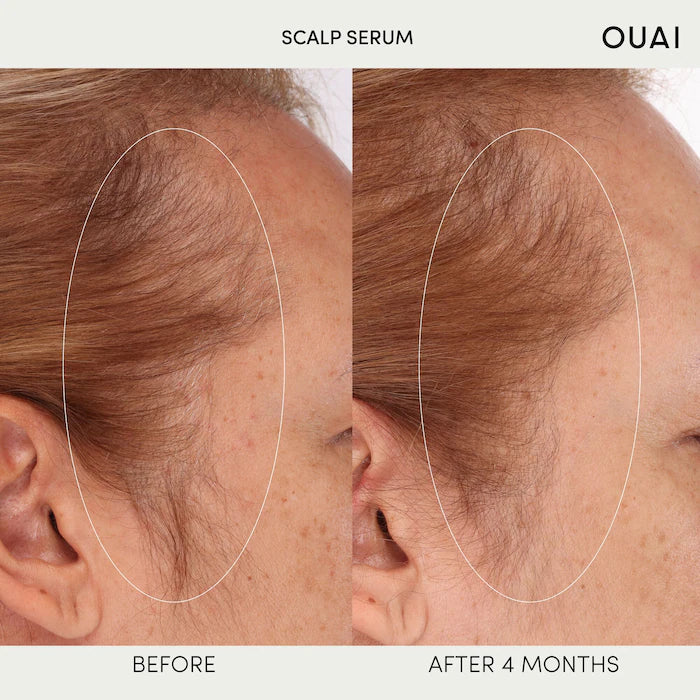 Hydrating Scalp Serum for Healthy, Fuller Looking Hair - PREVENTA