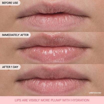 Bouncy & Firm Plumping Lip Treatment - PREVENTA